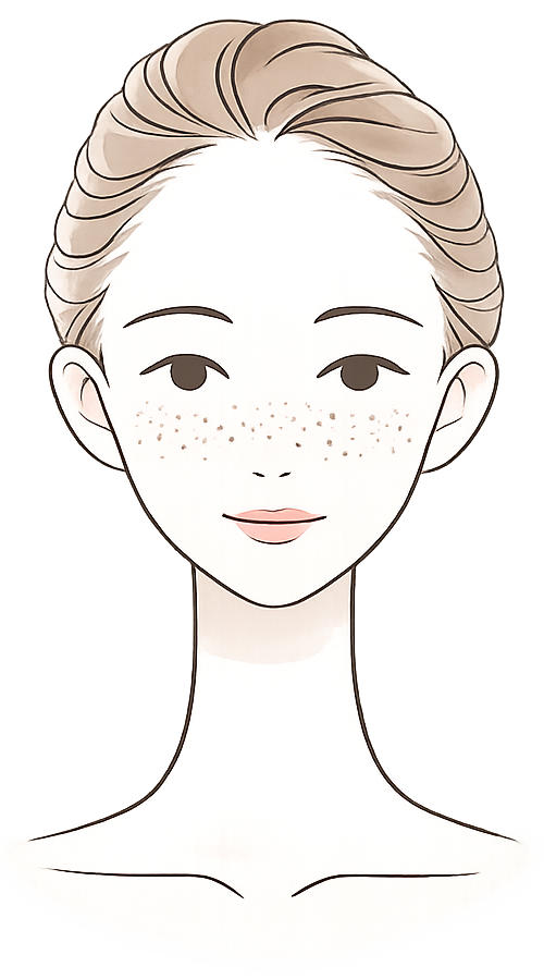 そばかす（雀卵斑）